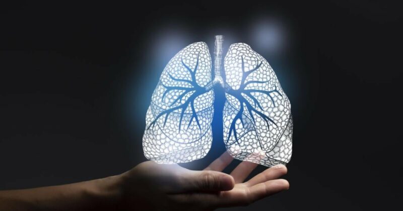 Lungenfibrose: Innovativer Therapieansatz könnte Transplantationen verhindern