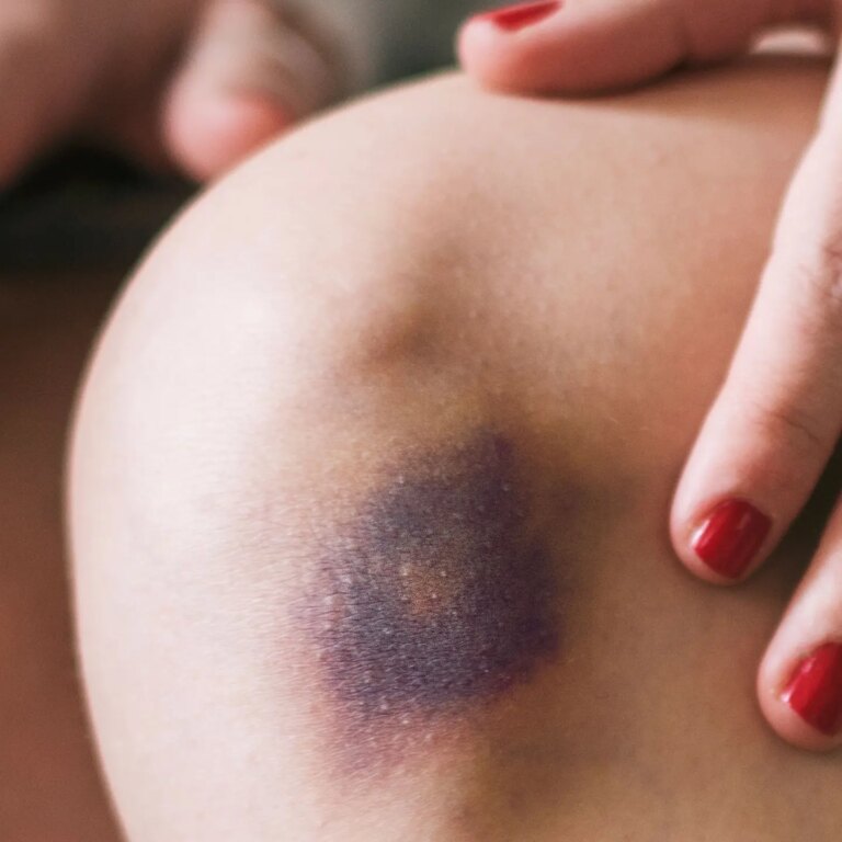 Kommt Schwarz-Blau an ihr Ende?