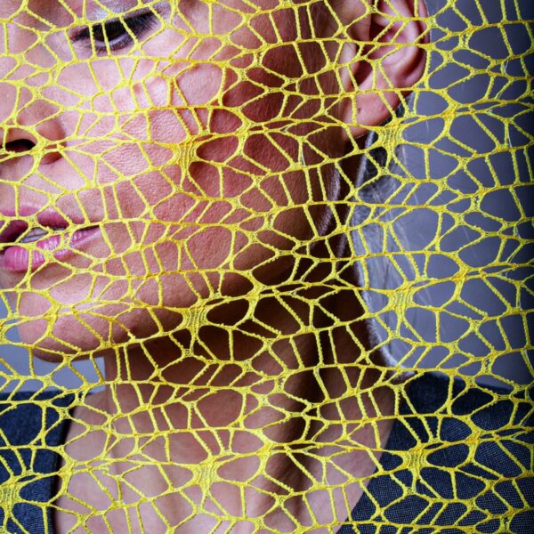 Psoriasis-Therapie: Neue Hoffnung dank Biologika
