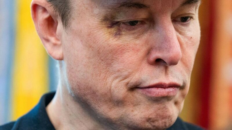 Elon Musk mit blauem Auge in Weißem Haus